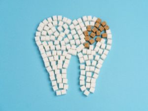 むし歯のイメージ、角砂糖でむし歯を表現し連想させる写真